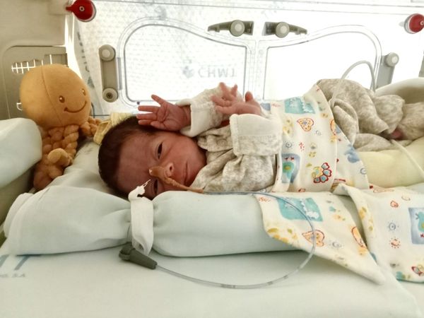 Ontem foi Dia Mundial da Prematuridade, conheça a história da pequena Margarida que o CHMT destacou nesta data