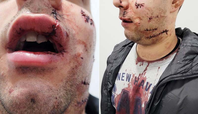 tomar militar gnr espacando cortado