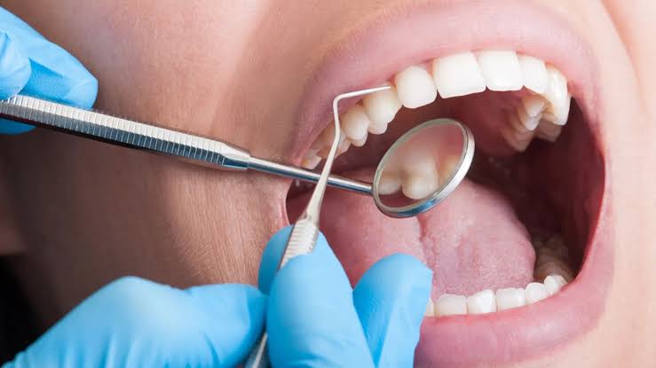 Assembleia da República aprova proposta do PS: SNS vai passar a ter dentistas